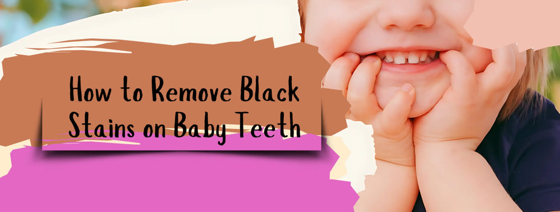 How to Remove Black Stains on Baby Teeth | Effective Tips & Tricks